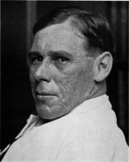 Stanley Rossiter Benedict